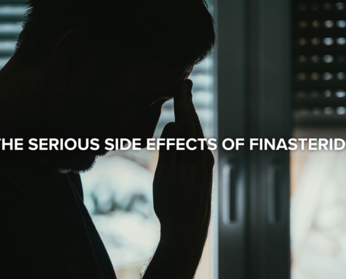 side effects finasteride