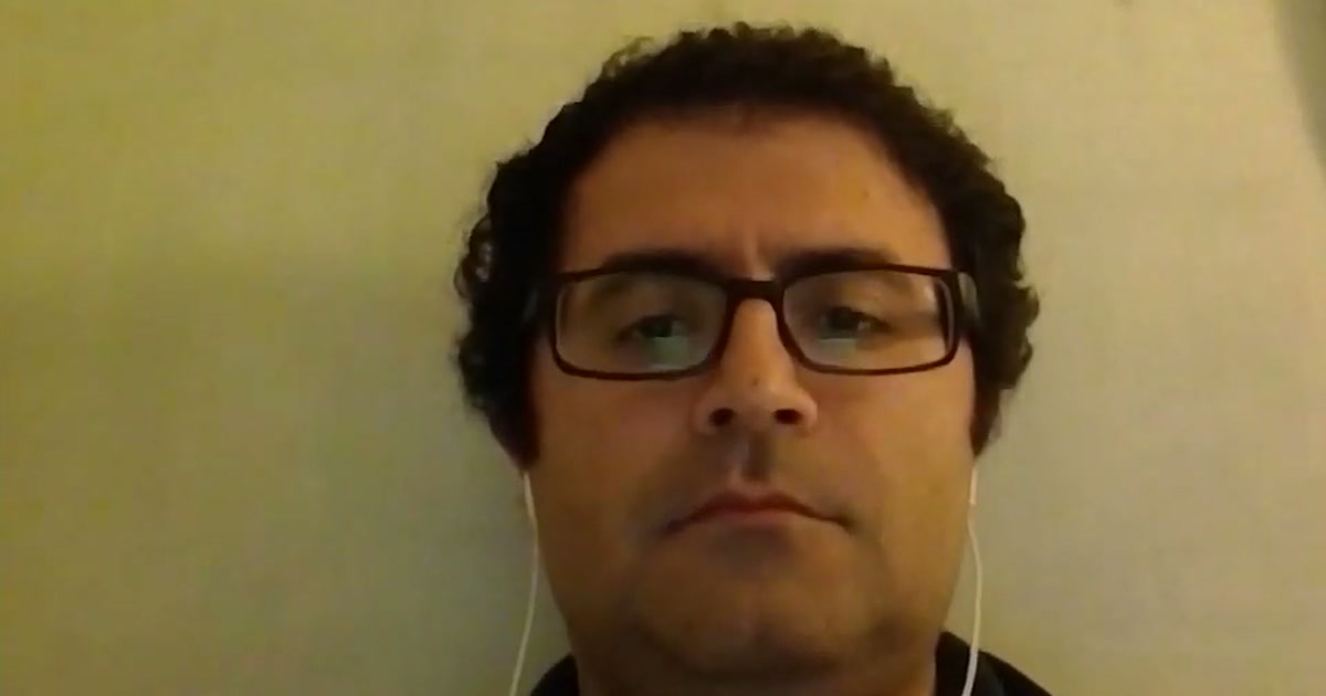 Ardalan's story: nearly 10 years on finasteride
